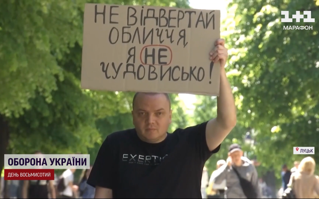 “Не відвертай обличчя, я не чудовисько”: військовий, який втратив ногу, влаштував акцію у Луцьку